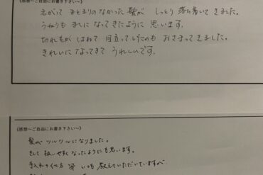 ”秋は抜け毛の季節？”